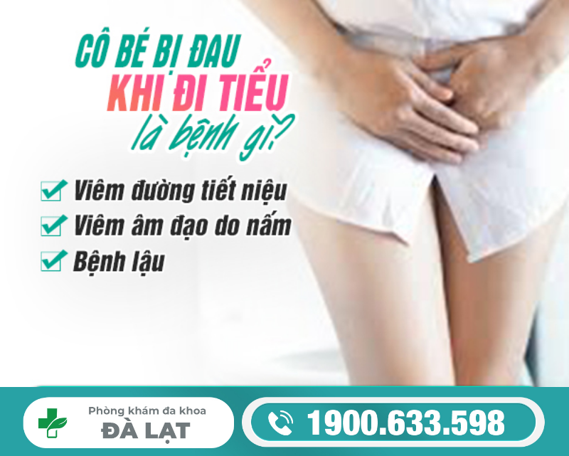 Hình ảnh minh họa